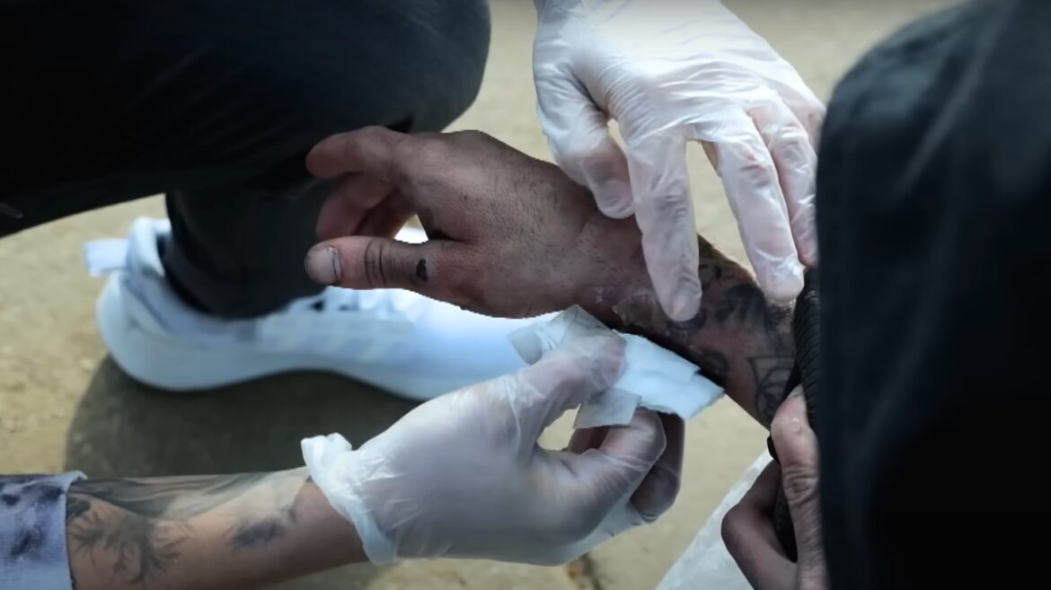 open-wond-door-nieuwe-drug-tranq